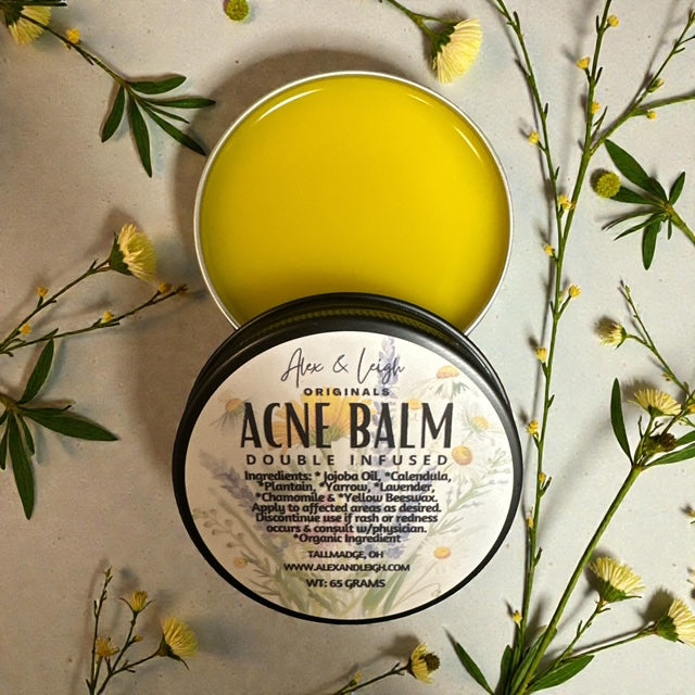 Acne Balm | Double Infused | Organic Ingredients |