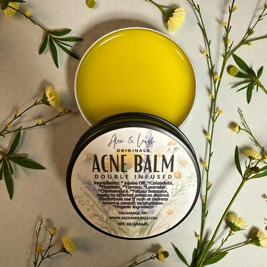 Acne Balm | Double Infused | Organic Ingredients |